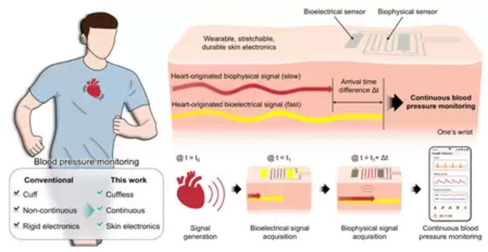 New bandage-like wearable monitor to enable continuous measurement of BP