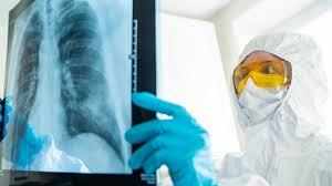 Researchers Develop AI to Detect COVID on Chest X-rays
