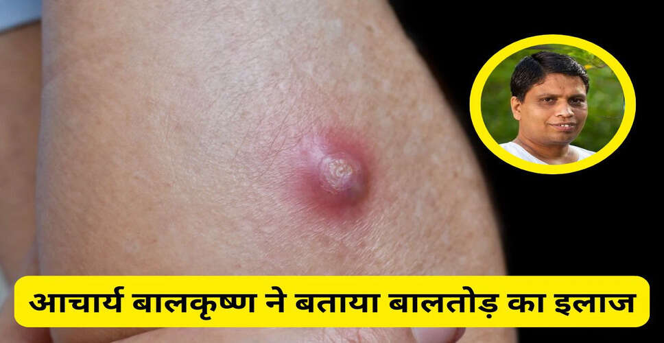 Effective Home Remedies for Treating Baltod