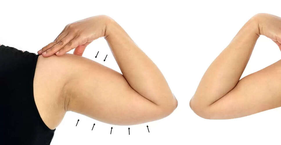 Effective Exercises to Tone Your Arms and Reduce Fat