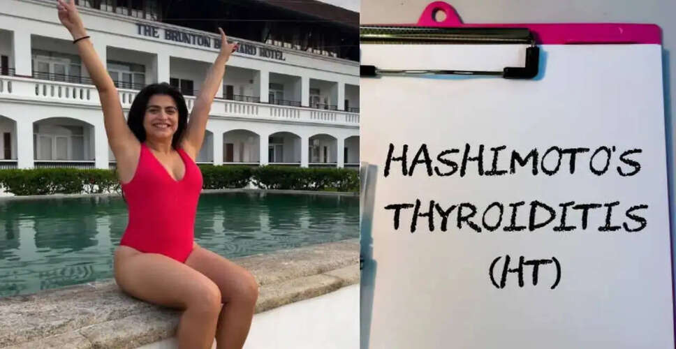 Shenaz Treasury Discusses Her Struggle with Hashimoto&rsquo;s Thyroiditis