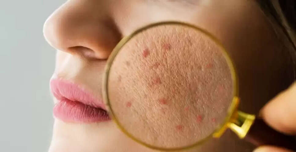 Combatting Dry Skin This Winter: The Role of Vitamin C