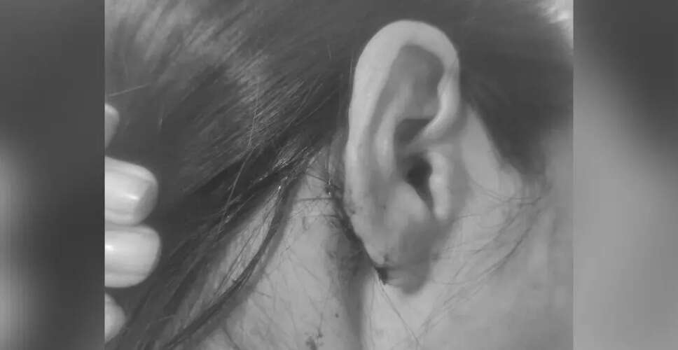 Assault on Woman and Third-Gender Friend in Delhi Sparks Outrage