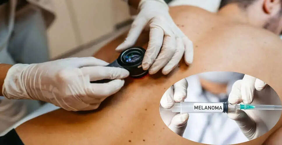 Innovative Personalized Cancer Vaccine Shows Promise Against Melanoma