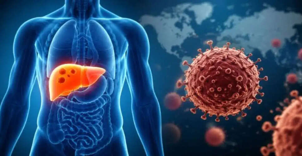 Understanding the Rising Threat of Viral Hepatitis: A Global Health Concern