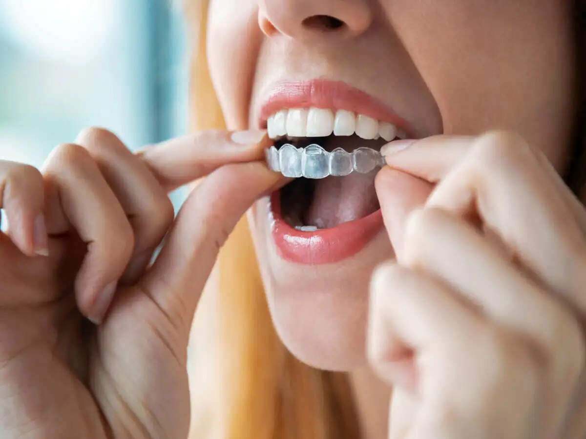 Essential Tips for Maintaining Your Clear Aligners