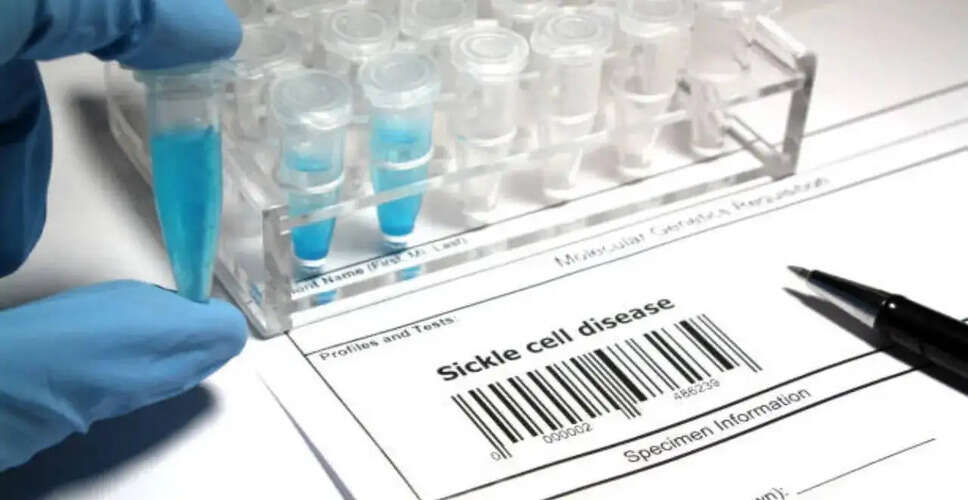 Understanding Sickle Cell Disease: Myths, Management, and Modern Treatments