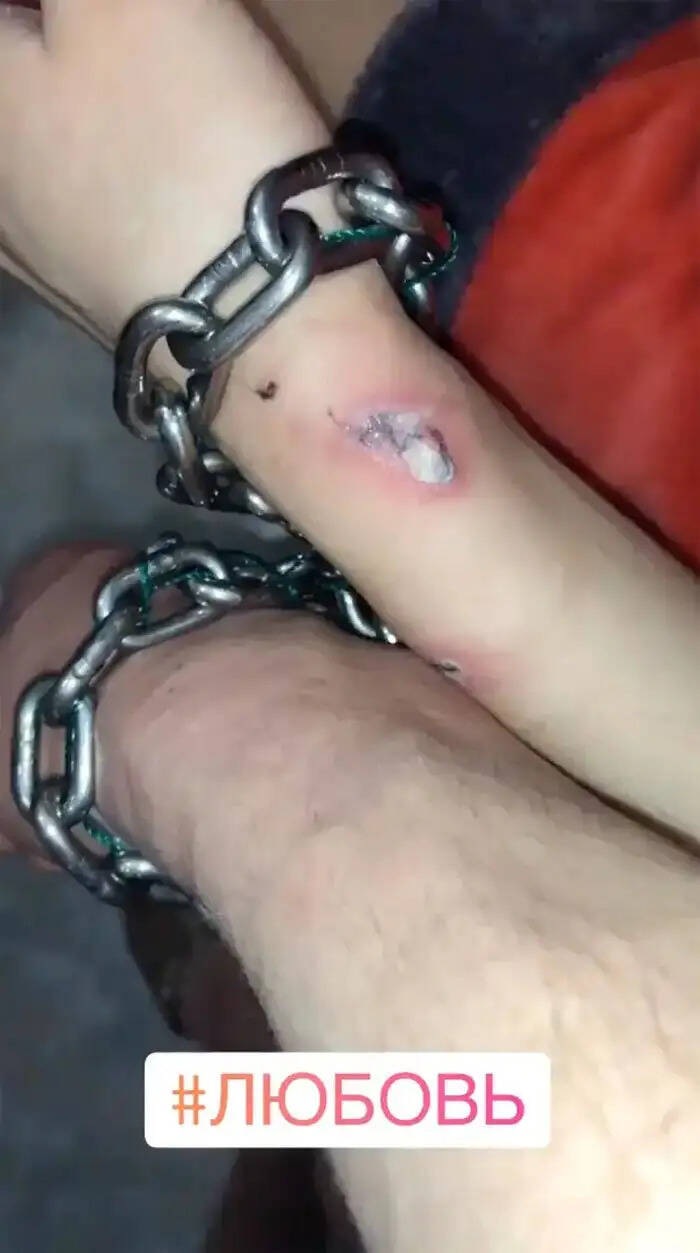 यूक्रेन में कपल का अनोखा शौक बना मुसीबत, अस्पताल में हुई भर्ती