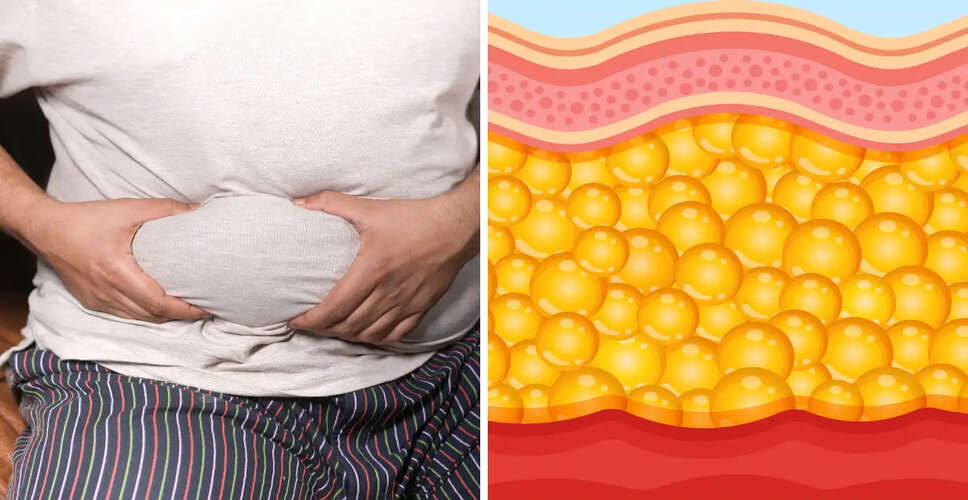 Understanding the Health Risks of Belly Fat and Its Causes