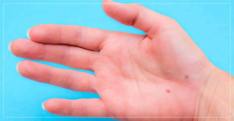 Exploring Wealth Indicators in Palmistry