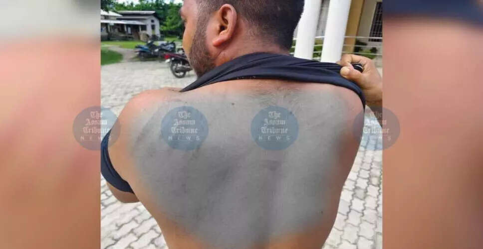 Journalist Injured in Assam During Panchayat Election Coverage