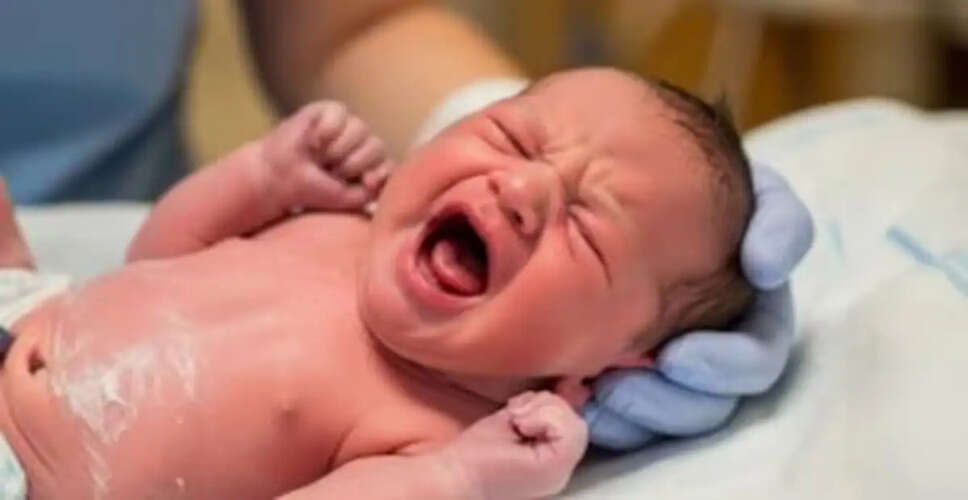 Understanding Newborn Skin Color Changes: Insights from Pediatric Experts