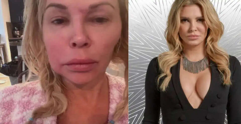 Brandi Glanville Reveals Benign Tumor Diagnosis Amid Ongoing Health Struggles