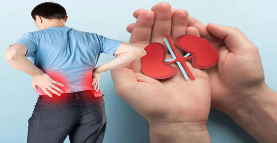 Understanding Kidney Stones: Causes, Risks, and Prevention