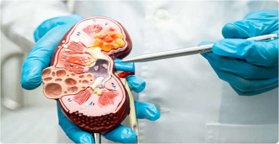 Understanding Kidney Health: Risks and Prevention Strategies