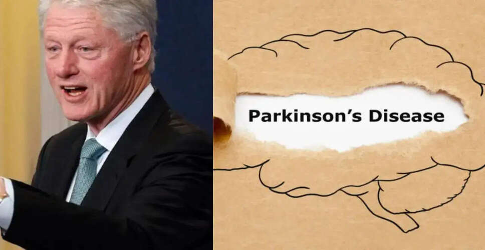 Understanding Parkinson's Disease: Insights from Bill Clinton's Health Speculations