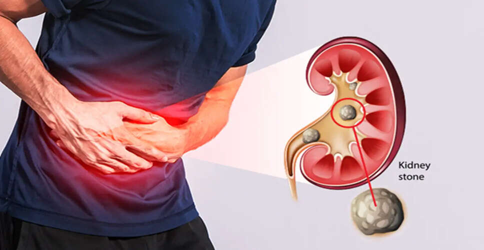Understanding Kidney Cancer vs. Kidney Stones: Key Differences