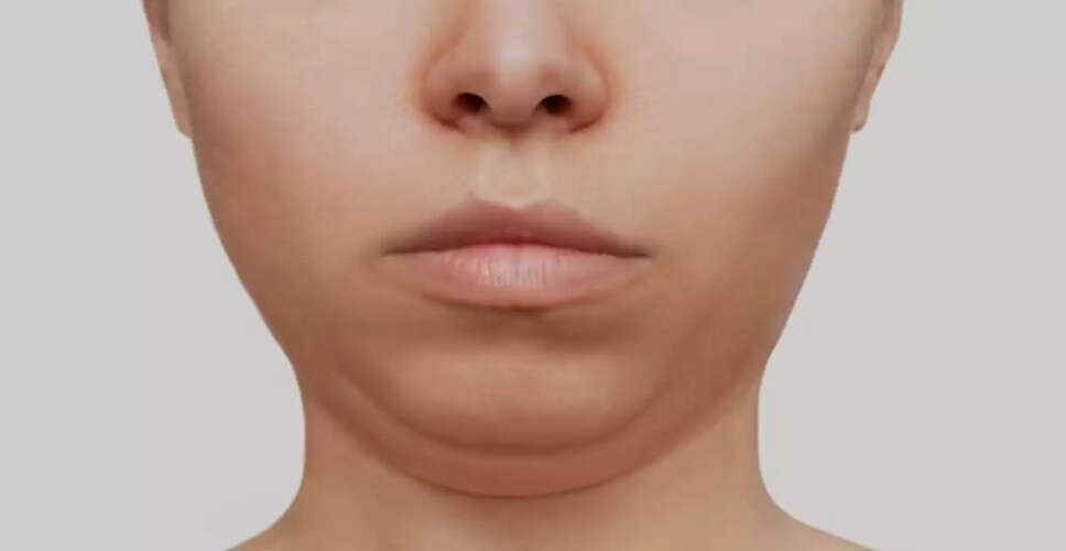 Effective Exercises to Eliminate Double Chin and Boost Confidence