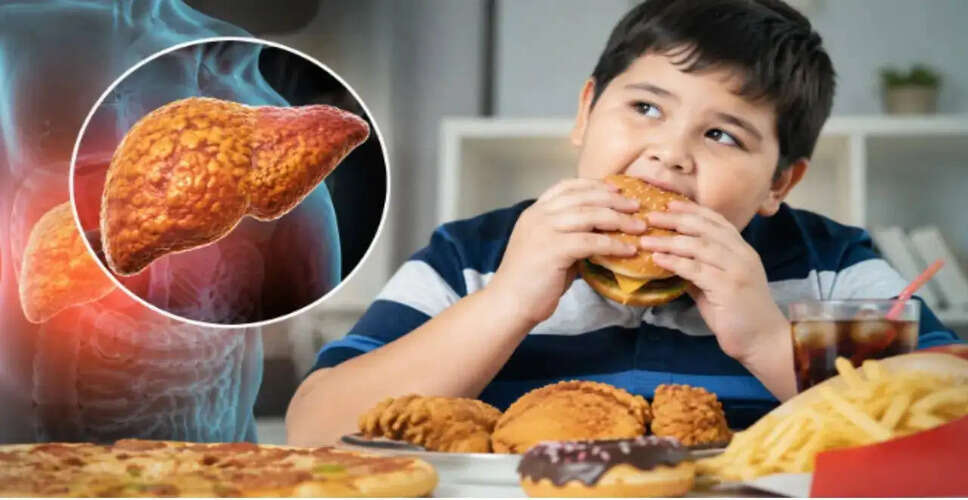 Rising Cases of Fatty Liver Disease in Children: A Growing Concern