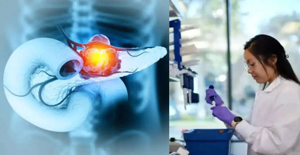 Breakthrough Drug Daraxonrasib Offers New Hope for Pancreatic Cancer Patients