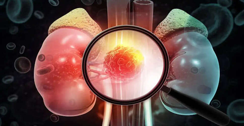 Understanding Kidney Cancer: The Silent Threat and Importance of Early Detection