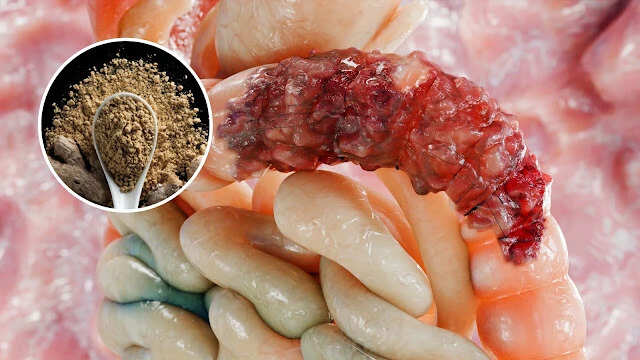 Effective Remedies for IBS: Tips from a Harvard-Trained Doctor