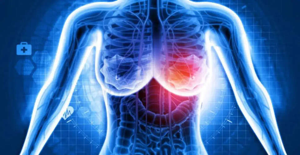 Understanding Grade 1 Breast Cancer: Insights and Treatment Options