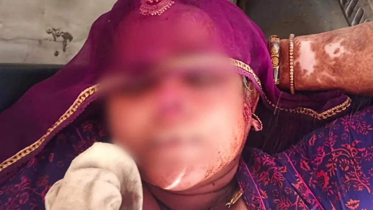 Shocking Incident in Rajasthan: Son-in-Law Attacks Mother-in-Law