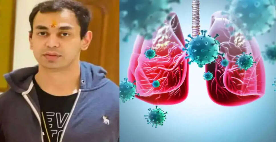 Understanding the Risks of Serious Lung Diseases: Insights from Prateek Yadav's Case