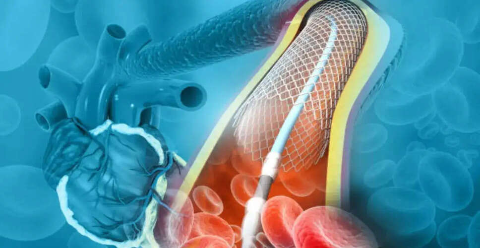 Understanding Heart Stent Complications and Prevention Strategies