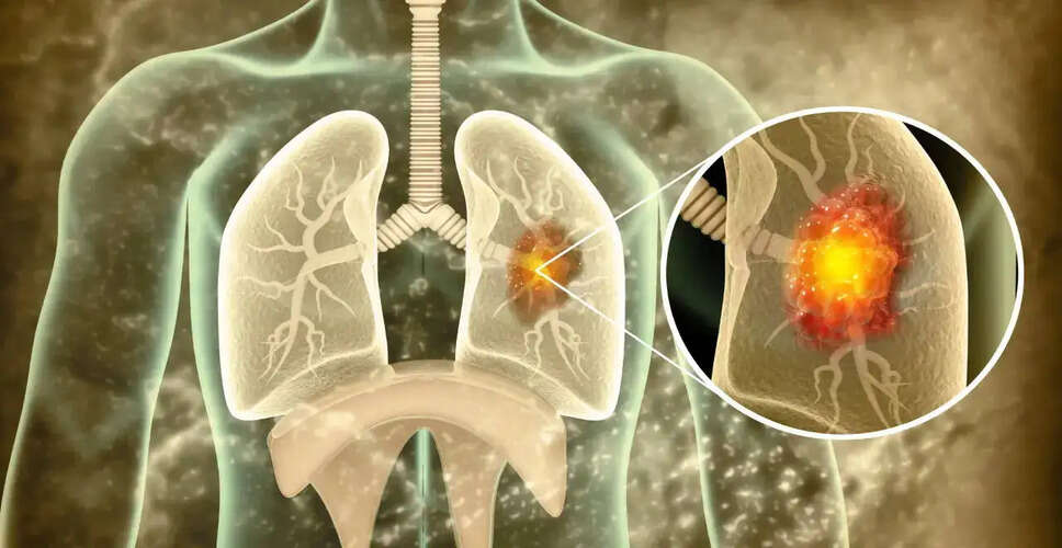 Understanding Tuberculosis: Symptoms, Risks, and Prevention Strategies