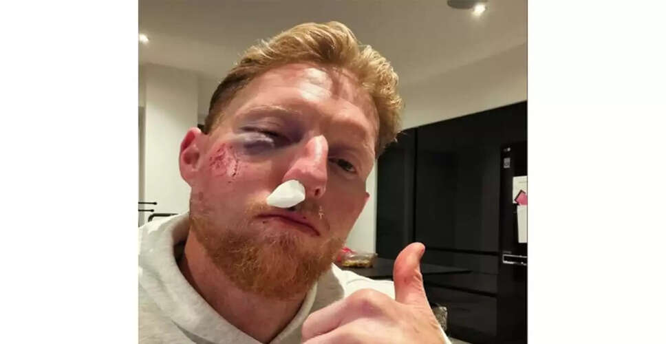 Ben Stokes Suffers Facial Injury Ahead of Upcoming Matches