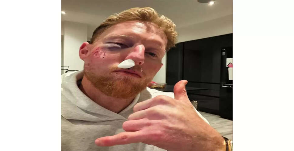 Ben Stokes Faces Facial Injury Ahead of Upcoming Matches