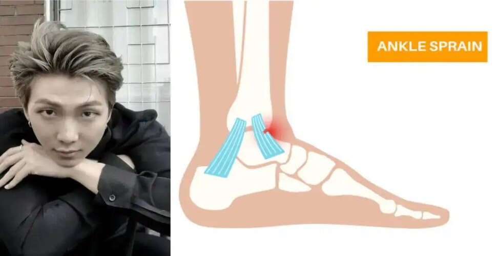 BTS Leader RM Faces Ankle Injury Ahead of Arirang Live Concert