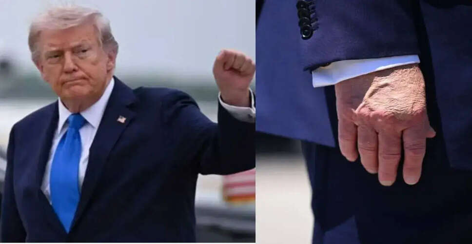 Speculation Surrounds Trump's Health After Recent Public Appearance