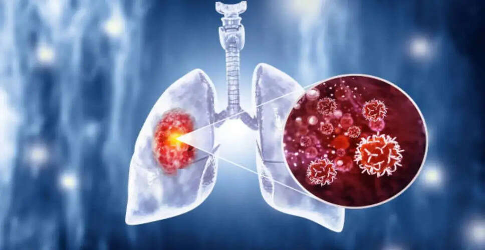 Innovative Blood Test Could Revolutionize Lung Cancer Prevention