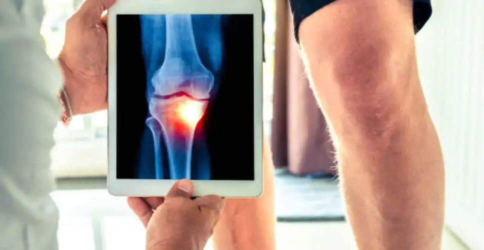 Exploring Regenerative Orthopaedics: A Shift Towards Non-Surgical Treatments