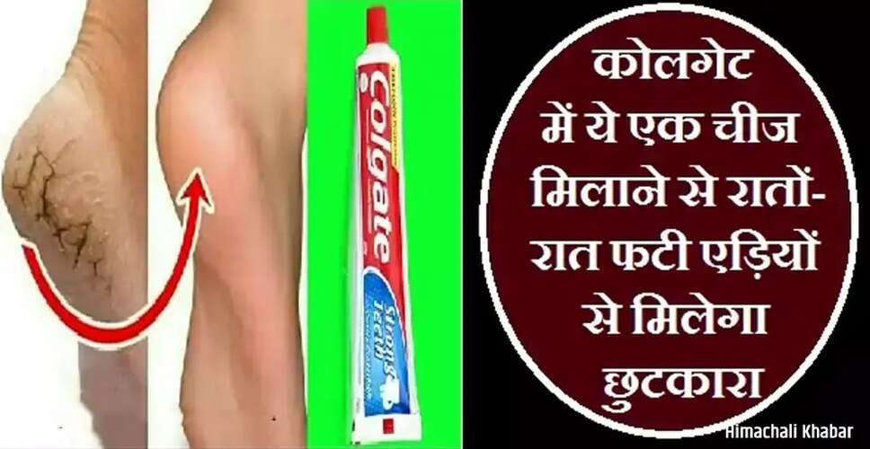 Effective Remedies for Cracked Heels: Achieve Soft Feet