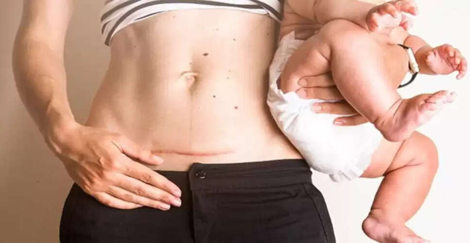 Post-C-Section Grooming: When Is It Safe to Wax and More?