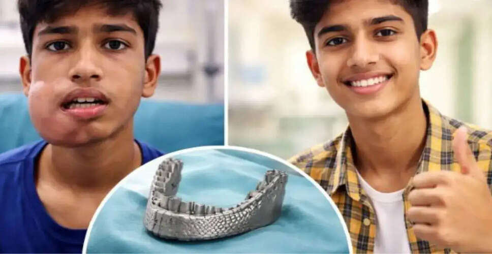 Innovative 3D-Printed Jaw Implant Transforms Teen's Life After Tumor Diagnosis