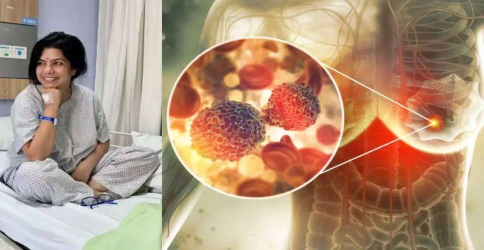 Rajshri Deshpande Shares Her Breast Cancer Journey: Importance of Early Detection