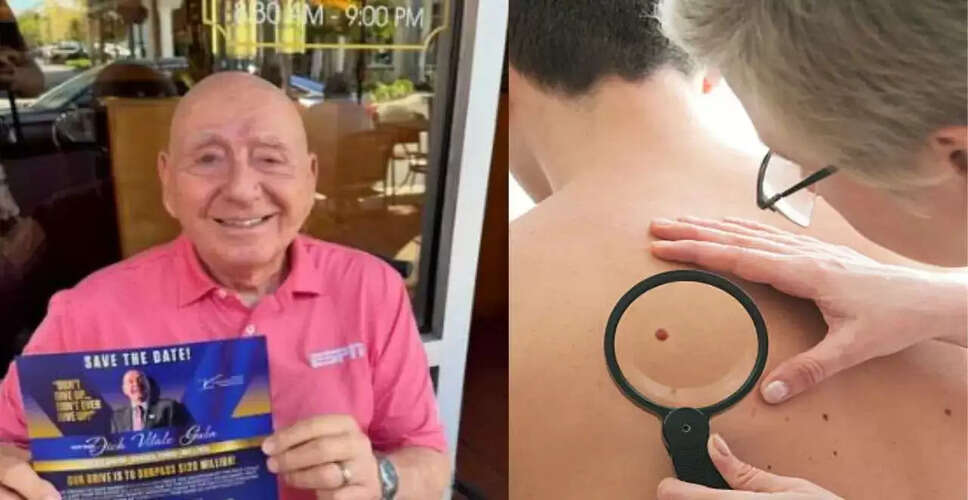 Dick Vitale Faces Fifth Cancer Battle: A Look at Melanoma and Its Impact