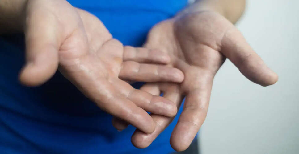 Understanding Hand Weakness and Sweaty Palms: When to Seek Medical Advice