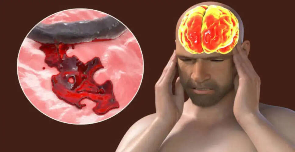 Kerala Issues Health Alert Over Amoebic Meningoencephalitis Risk