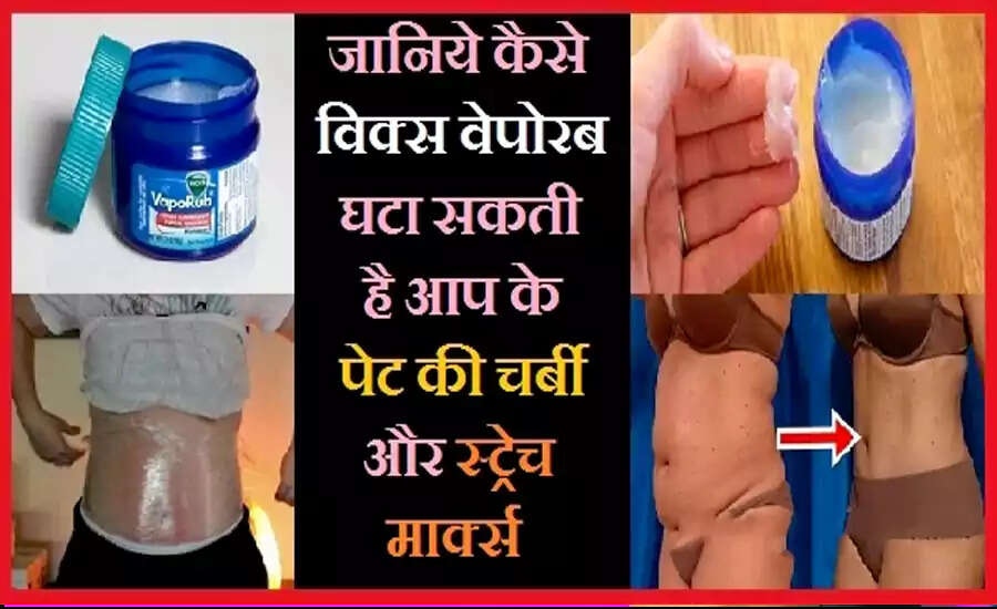 Innovative Uses of Vicks VapoRub Beyond Cold Relief