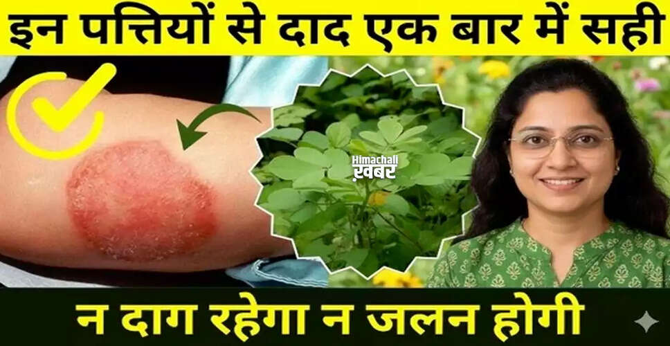 Effective Home Remedy to Eliminate Ringworm Permanently