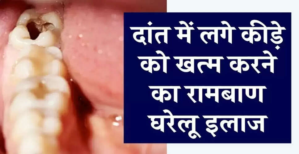 Effective Home Remedies to Treat Tooth Cavities