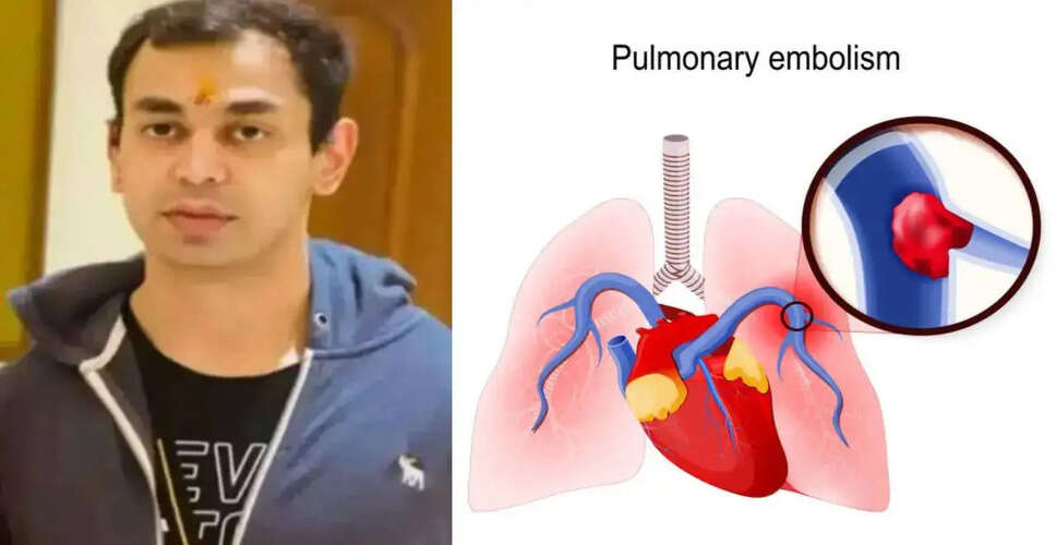 Understanding Massive Pulmonary Thromboembolism: A Life-Threatening Condition