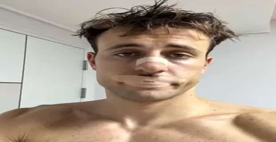 Social media fad of mouth taping during sleep may pose serious risks: Study