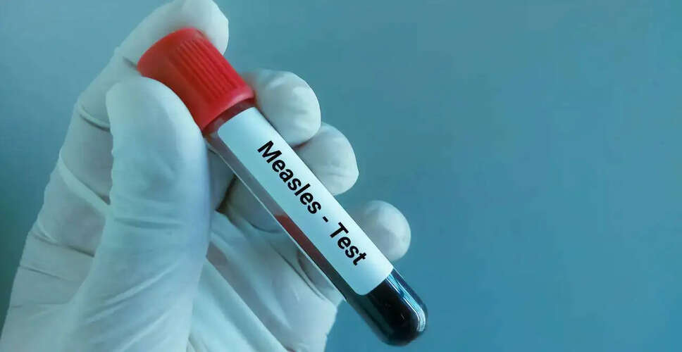 Measles Outbreak in Bangladesh Claims Lives of Seven Children in 24 Hours